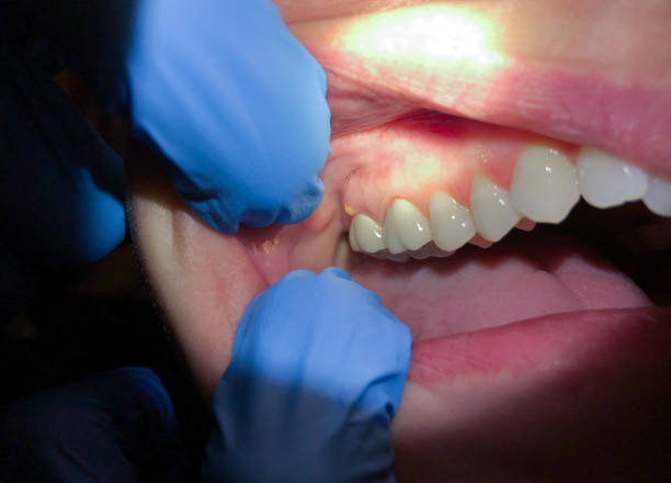  Vista Center, NJ Emergency Dentist Pros