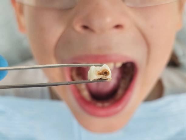 Best Root Canal Emergency Dentist  in Vista Center, NJ